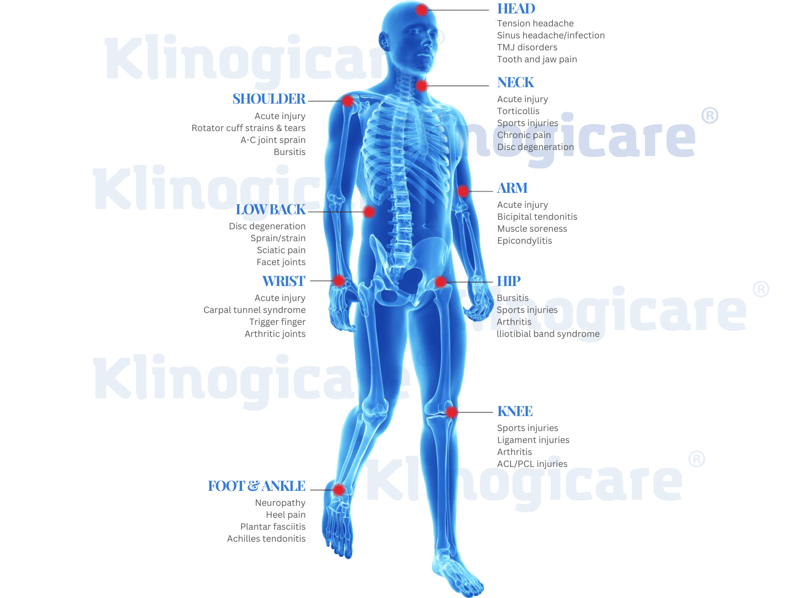 Atlante anatomico con le principali zone di applicazione della HILT: colonna vertebrale, grandi articolazioni, sistema nervoso periferico, muscoli, fasce, legamenti e tendini